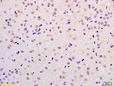 Immunohistochemistry (Formalin/PFA-fixed paraffin-embedded sections) - Anti-CHMP4B + CHMP4C antibody (AB217791), expandable thumbnail