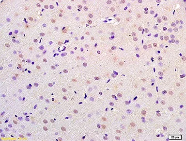 Immunohistochemistry (Formalin/PFA-fixed paraffin-embedded sections) - Anti-CHMP4B + CHMP4C antibody (AB217791)