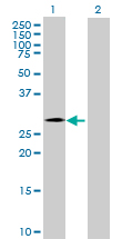 Western blot - Anti-CHMP4C antibody (AB168205), expandable thumbnail