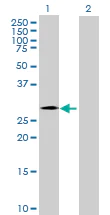 Western blot - Anti-CHMP4C antibody (AB168205)