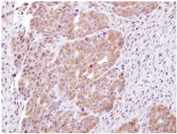 Immunohistochemistry (Formalin/PFA-fixed paraffin-embedded sections) - Anti-CHMP5 antibody (AB96273)