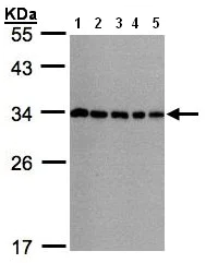 Western blot - Anti-CHMP5 antibody (AB96273)