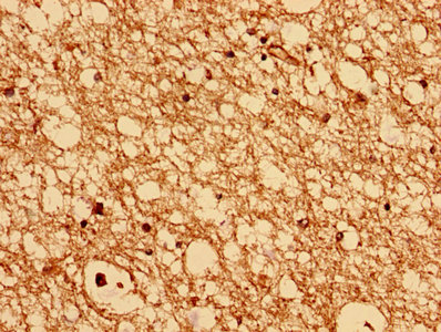 Immunohistochemistry (Formalin/PFA-fixed paraffin-embedded sections) - Anti-CHMP6/VPS20 antibody (AB235050)