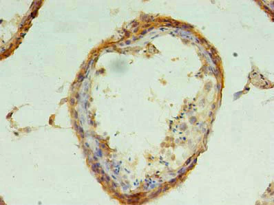 Immunohistochemistry (Formalin/PFA-fixed paraffin-embedded sections) - Anti-CHMP6/VPS20 antibody (AB235050)