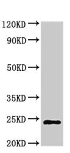 Western blot - Anti-CHMP6/VPS20 antibody (AB235050)