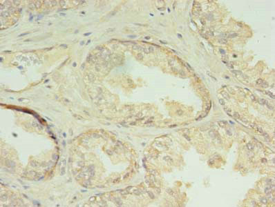 Immunohistochemistry (Formalin/PFA-fixed paraffin-embedded sections) - Anti-CHMP7 antibody (AB238552)