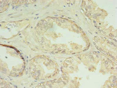Immunohistochemistry (Formalin/PFA-fixed paraffin-embedded sections) - Anti-CHMP7 antibody (AB238552)