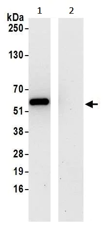 Immunoprecipitation - Anti-CHMP7 antibody (AB242221)