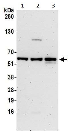 Western blot - Anti-CHMP7 antibody (AB242221)