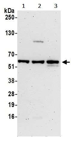Western blot - Anti-CHMP7 antibody (AB242221)