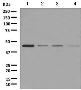 Western blot - Anti-CHN 1 antibody [EPR9906] (AB156869)