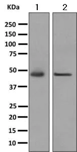 Western blot - Anti-CHN 1 antibody [EPR9906] (AB156869)