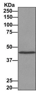 Immunoprecipitation - Anti-CHN 1 antibody [EPR9906] - BSA and Azide free (AB249283)