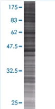 SDS-PAGE - CHN 1 overexpression 293T lysate (whole cell) (AB94168)