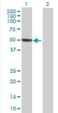 Western blot - CHN 1 overexpression 293T lysate (whole cell) (AB94168)