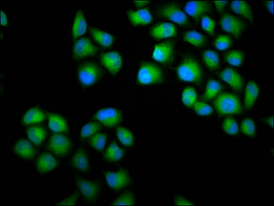 Immunocytochemistry/ Immunofluorescence - Anti-CHODL antibody (AB236742)