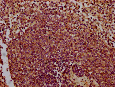 Immunohistochemistry (Formalin/PFA-fixed paraffin-embedded sections) - Anti-CHODL antibody (AB236742)