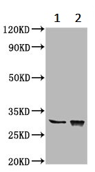 Western blot - Anti-CHODL antibody (AB236742)