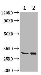 Western blot - Anti-CHODL antibody (AB236742)