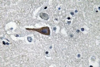 Immunohistochemistry (Formalin/PFA-fixed paraffin-embedded sections) - Anti-Cholecystokinin antibody (AB134713)
