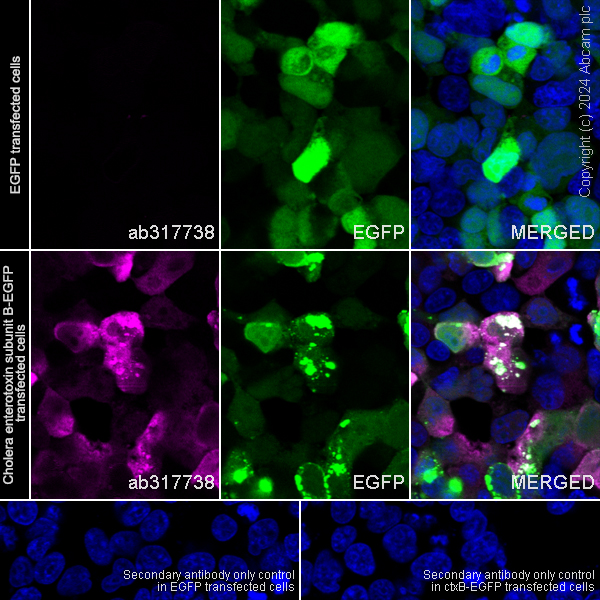 Immunocytochemistry/ Immunofluorescence - Anti-Cholera enterotoxin subunit B antibody [EPR27372-4] (AB317738), expandable thumbnail