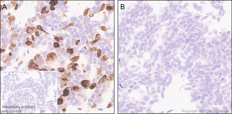 Immunohistochemistry (Formalin/PFA-fixed paraffin-embedded sections) - Anti-Cholera enterotoxin subunit B antibody [EPR27372-4] (AB317738)