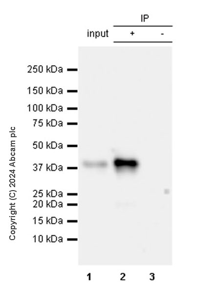 Immunoprecipitation - Anti-Cholera enterotoxin subunit B antibody [EPR27372-4] (AB317738), expandable thumbnail