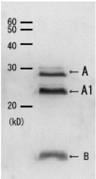 Western blot - Anti-Cholera Toxin antibody (AB123129)