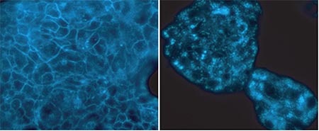 Fluorescence Microscopy - Cholesterol Assay Kit (Cell-Based) (AB133116), expandable thumbnail