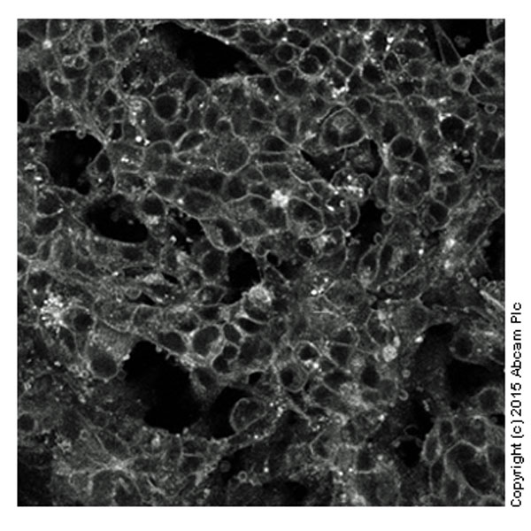 Fluorescence Microscopy - Cholesterol Assay Kit (Cell-Based) (ab133116), expandable thumbnail