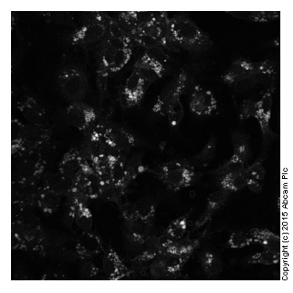 Fluorescence Microscopy - Cholesterol Assay Kit (Cell-Based) (AB133116), expandable thumbnail
