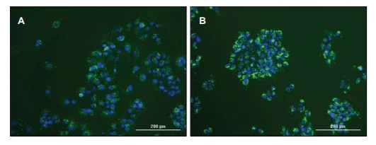 Functional Studies - Cholesterol Uptake Assay Kit (AB236212)