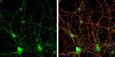 Immunocytochemistry/ Immunofluorescence - Anti-Choline Acetyltransferase antibody (AB137349)