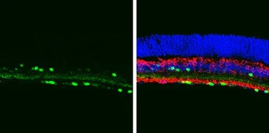 Immunohistochemistry (Frozen sections) - Anti-Choline Acetyltransferase antibody (AB137349)