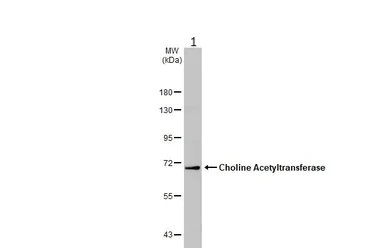 Western blot - Anti-Choline Acetyltransferase antibody (AB137349)