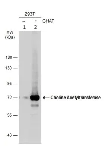 Western blot - Anti-Choline Acetyltransferase antibody (AB137349)