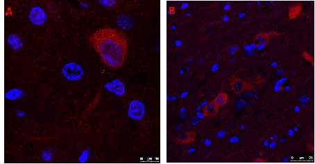 Immunocytochemistry/ Immunofluorescence - Anti-Choline Acetyltransferase antibody (AB18736), expandable thumbnail
