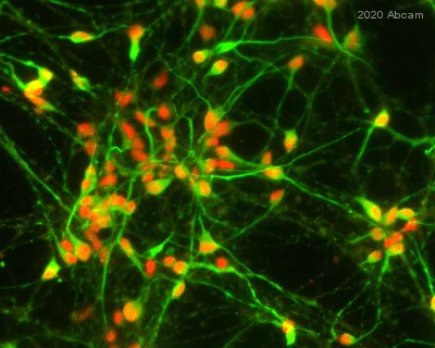 Immunocytochemistry - Anti-Choline Acetyltransferase antibody (AB223346)