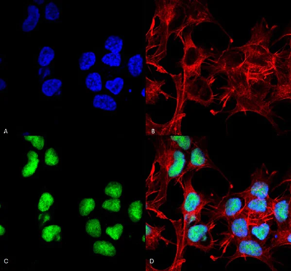 Immunocytochemistry/ Immunofluorescence - Anti-Choline Acetyltransferase antibody (AB223346)
