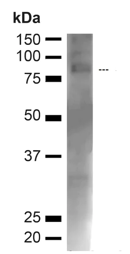 Western blot - Anti-Choline Acetyltransferase antibody (AB223346)