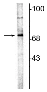 Western blot - Anti-Choline Acetyltransferase antibody (AB254118)
