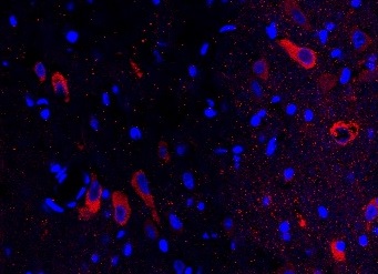 Immunohistochemistry - Free Floating - Anti-Choline Acetyltransferase antibody (AB6168), expandable thumbnail