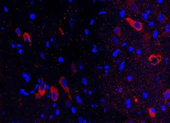 Immunohistochemistry - Free Floating - Anti-Choline Acetyltransferase antibody (AB6168)