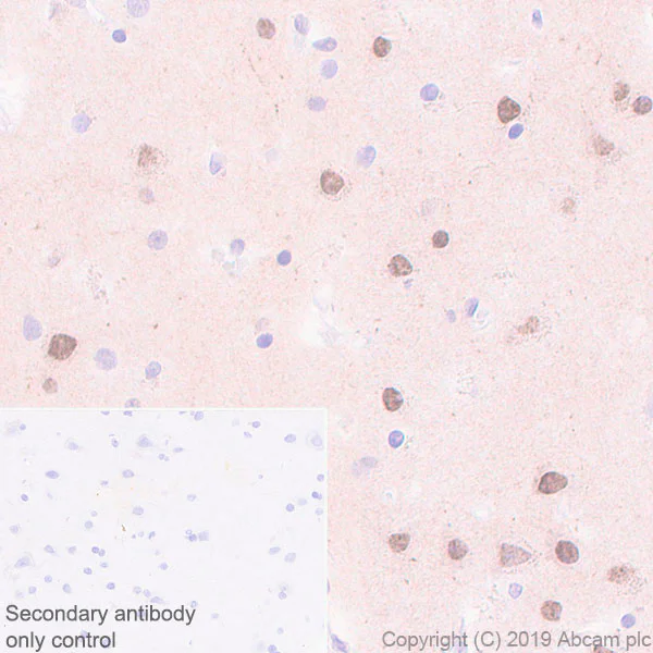 Immunohistochemistry (Formalin/PFA-fixed paraffin-embedded sections) - Anti-Choline Acetyltransferase antibody [EPR13024(B)] (AB181023)