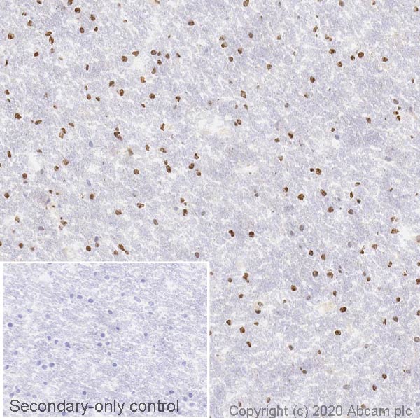 Immunohistochemistry (Frozen sections) - Anti-Choline Acetyltransferase antibody [EPR13024(B)] (AB181023), expandable thumbnail