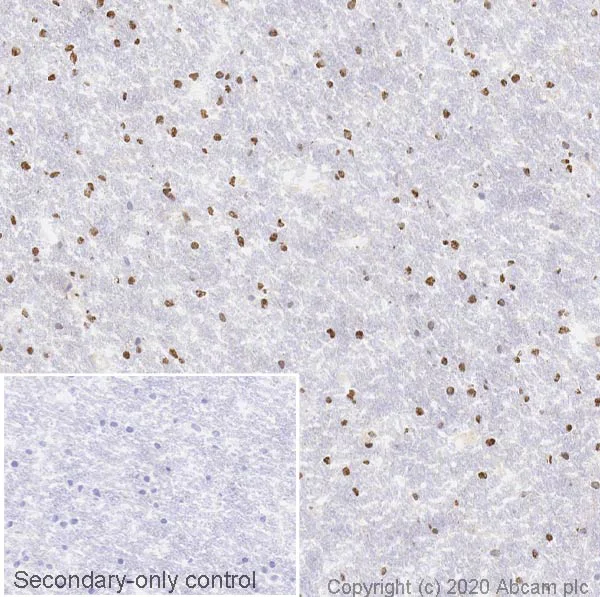 Immunohistochemistry (Frozen sections) - Anti-Choline Acetyltransferase antibody [EPR13024(B)] (AB181023)