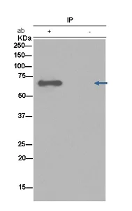 Immunoprecipitation - Anti-Choline Acetyltransferase antibody [EPR13024(B)] (AB181023)