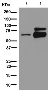 Western blot - Anti-Choline Acetyltransferase antibody [EPR13024(B)] (AB181023)