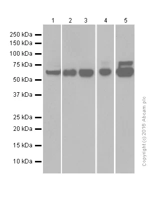 Western blot - Anti-Choline Acetyltransferase antibody [EPR13024(B)] (AB181023)