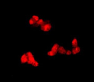 Immunocytochemistry/ Immunofluorescence - Anti-Choline Acetyltransferase antibody [EPR13024(B)] - BSA and Azide free (ab224267), expandable thumbnail